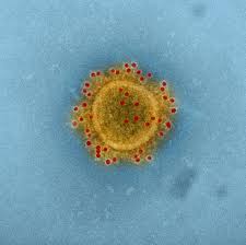 Coronavirus: La Rep. Checa y sus preparativos
