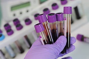 Tenemos 1 497 casos confirmados de contagiados con covid-19